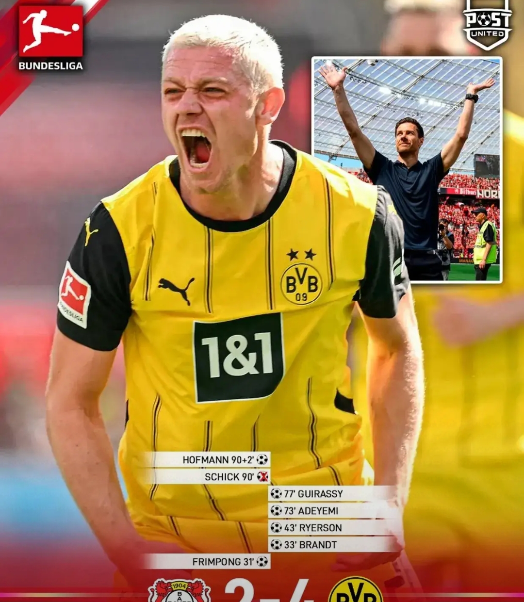 包含多特蒙德迎荷甲关键赛，加时末段伤情更新，媒体盛赞，年轻球员得到机会的词条